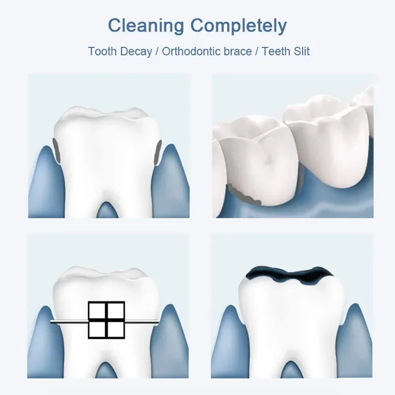 Irrigador Bucal Portátil 2 en 1 Grifo Cepillo de Dientes Nuevo Limpiador Dental con Chorro de Agua para el Hogar Sin Necesidad de Energía