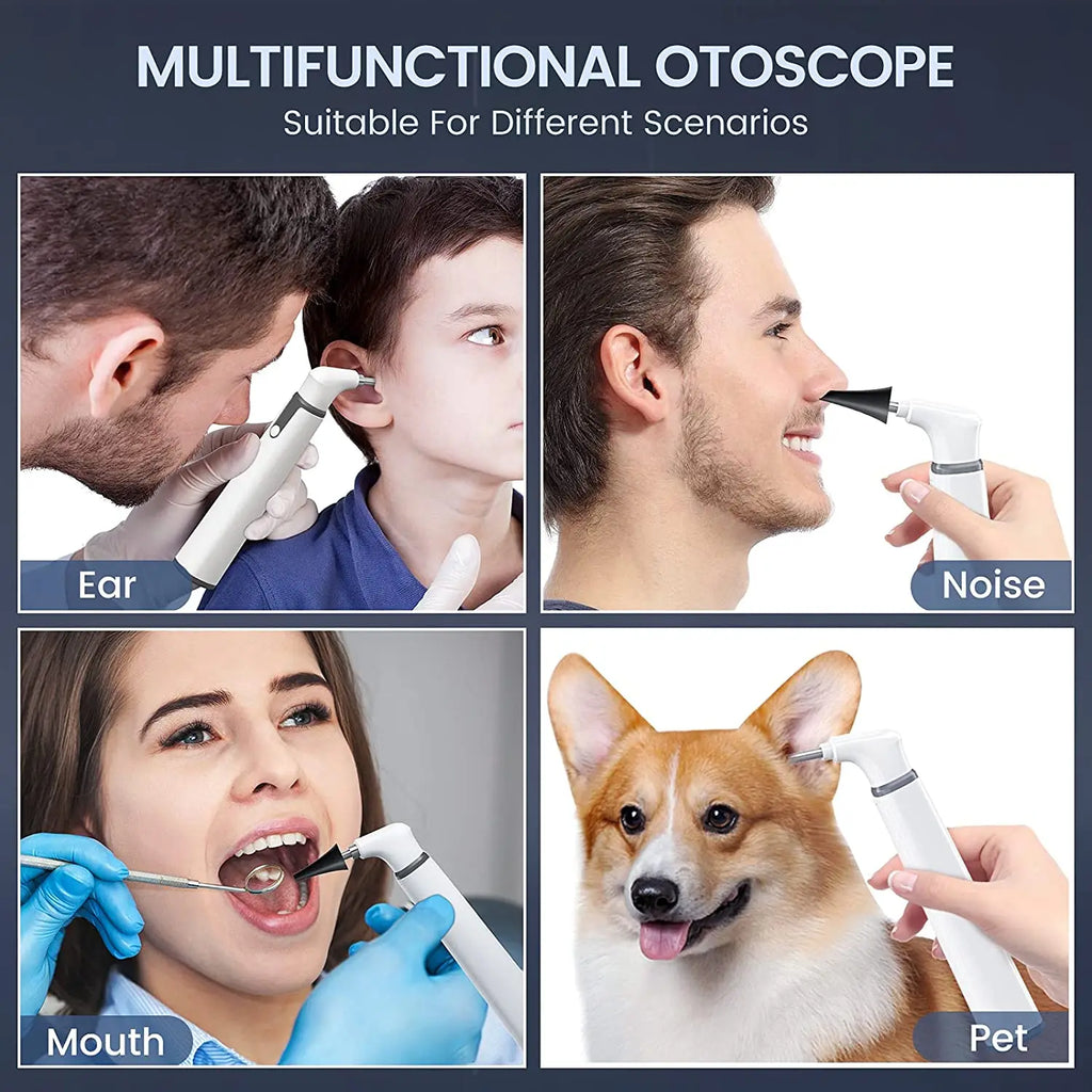 Cámara de oído otoscopio inalámbrico con doble vista, endoscopio de oído WiFi de 3.9 mm 720PHD con 6 luces LED para niños y adultos, compatible